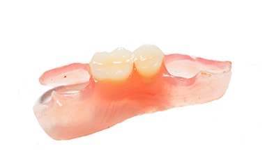 ノンクラスプ義歯と通常の部分義歯
